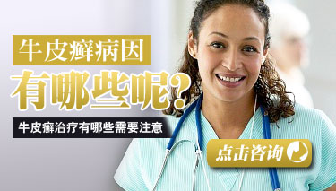 哪些引发成人牛皮癣